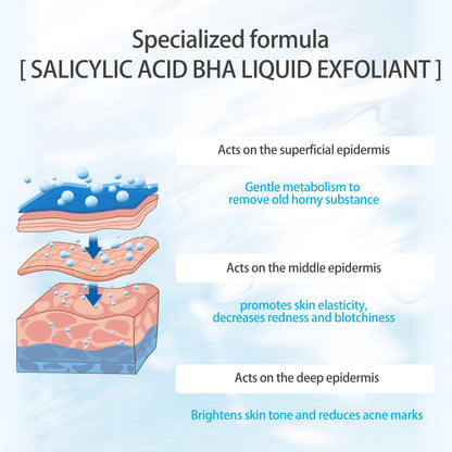 2% Salicylic Acid Liquid Exfoliant