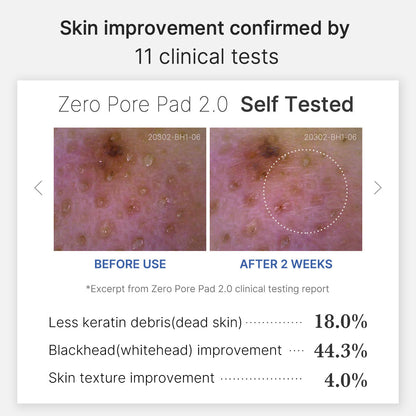 Mirco Pore Pads (AHA + BHA) |Acne