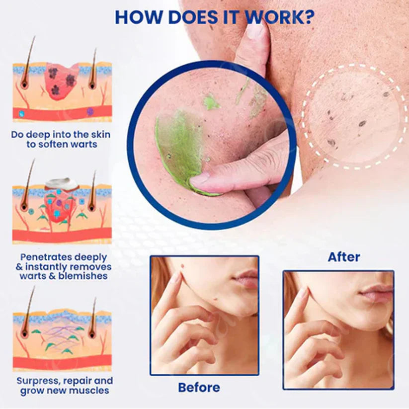 Pimple & Scar Solution