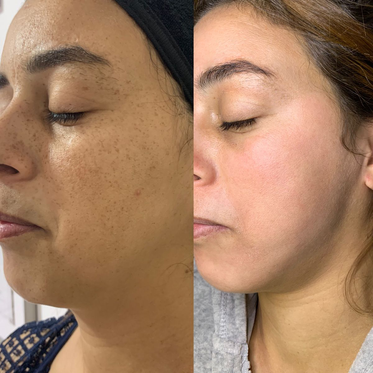 Éternelle Lumière Collagen Spot
