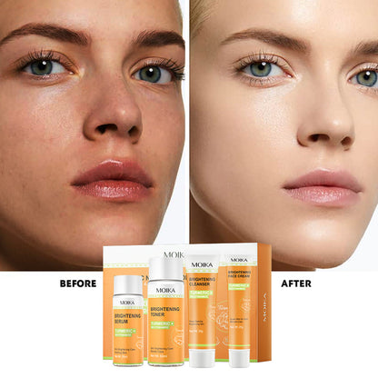 Turmeric + Nicotinamide Brightening Skincare Set