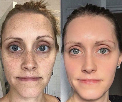 Éternelle Lumière Collagen Spot