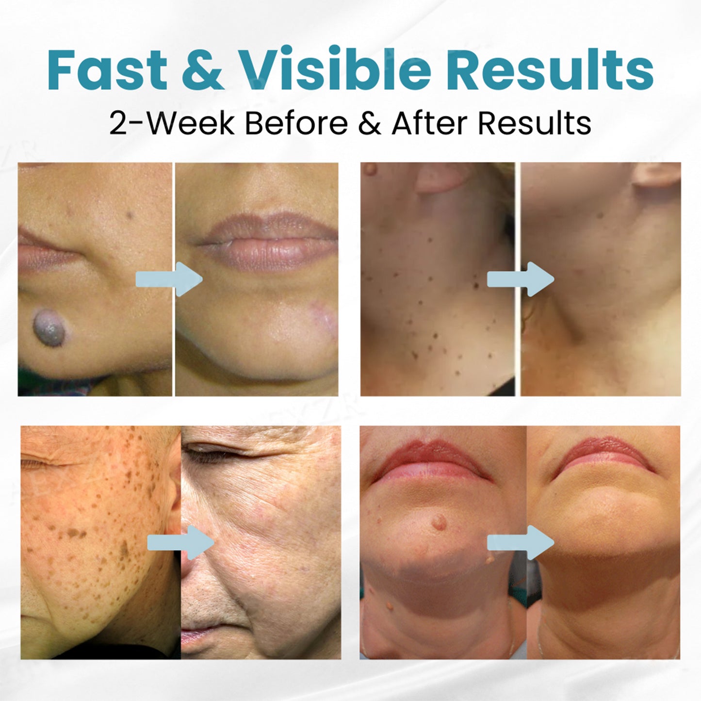 Pimple & Scar Solution