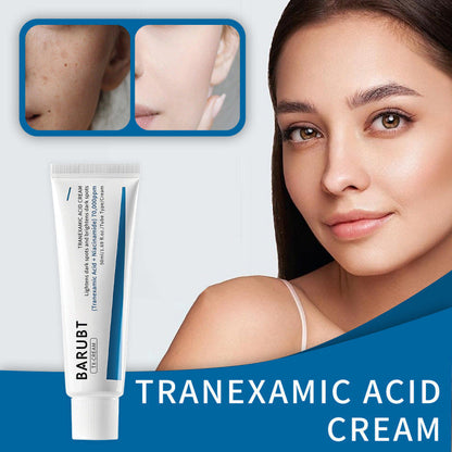 TX Tranexamic Acid CREAM | Skin freckle Cream, Blemishes, Anti