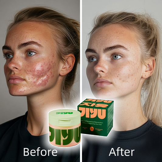 Korean Skincare Toner Pads – Anti