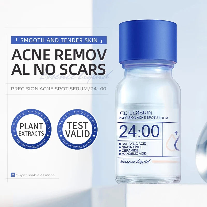 Acne Drying Lotion