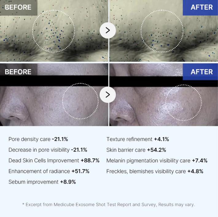 Ultimate Dark Spot Removal Duo