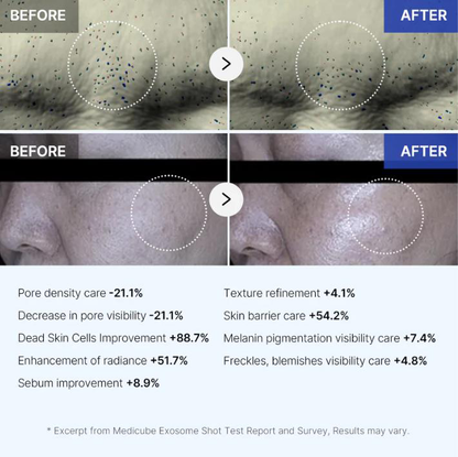Ultimate Dark Spot Removal Duo